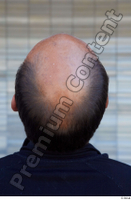  Street  805 bald hair head 0001.jpg